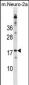RPL30 Antibody(N-term)
